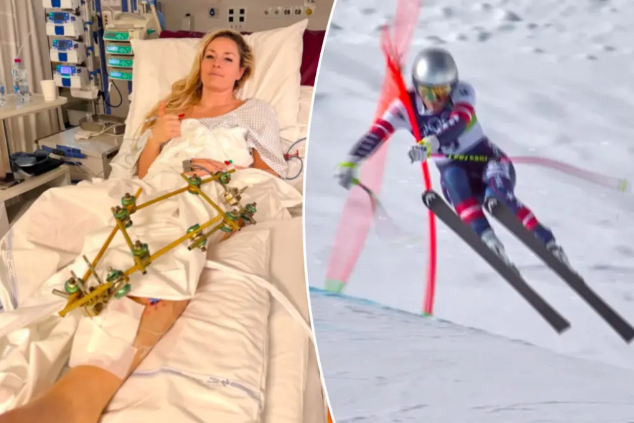 Вон им се обрати на фановите по четвртата операција