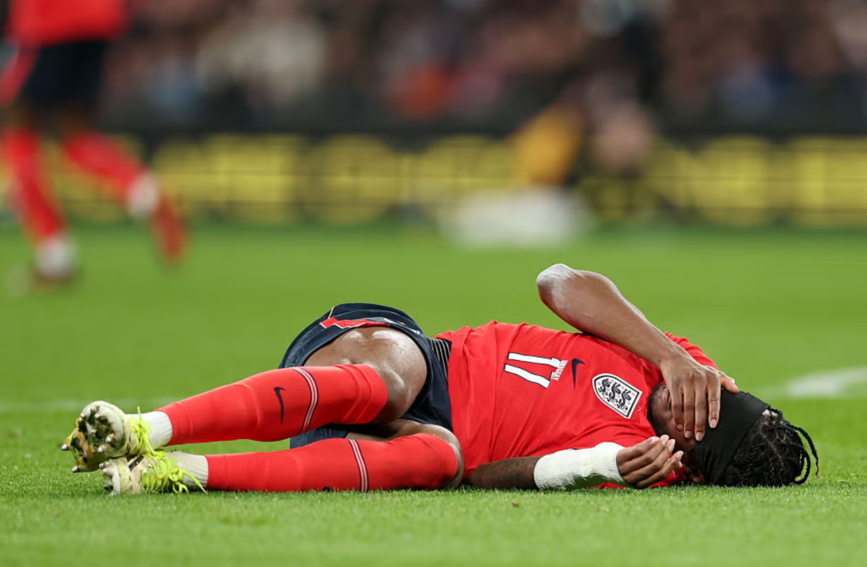 Нови проблеми за Артета, се повреди и Мадуеке